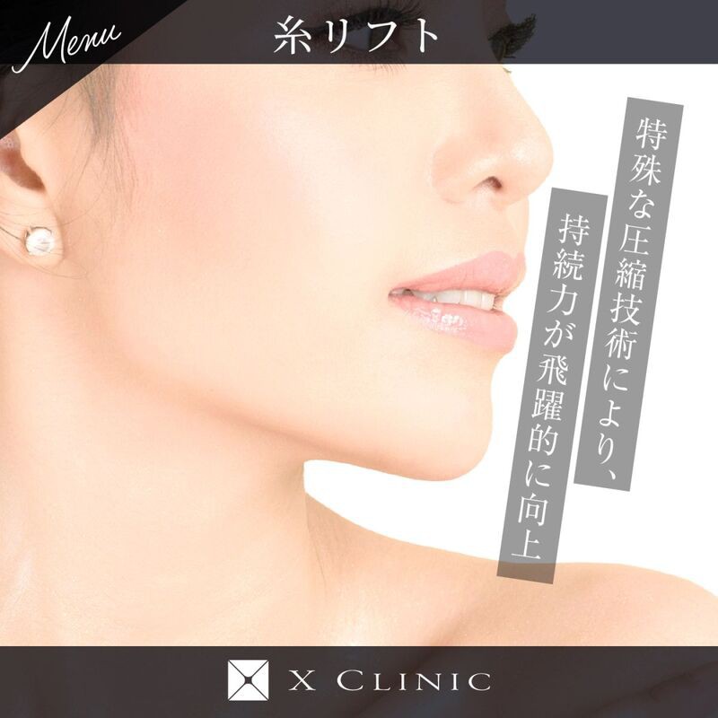 糸リフト(アンジェラリフト)