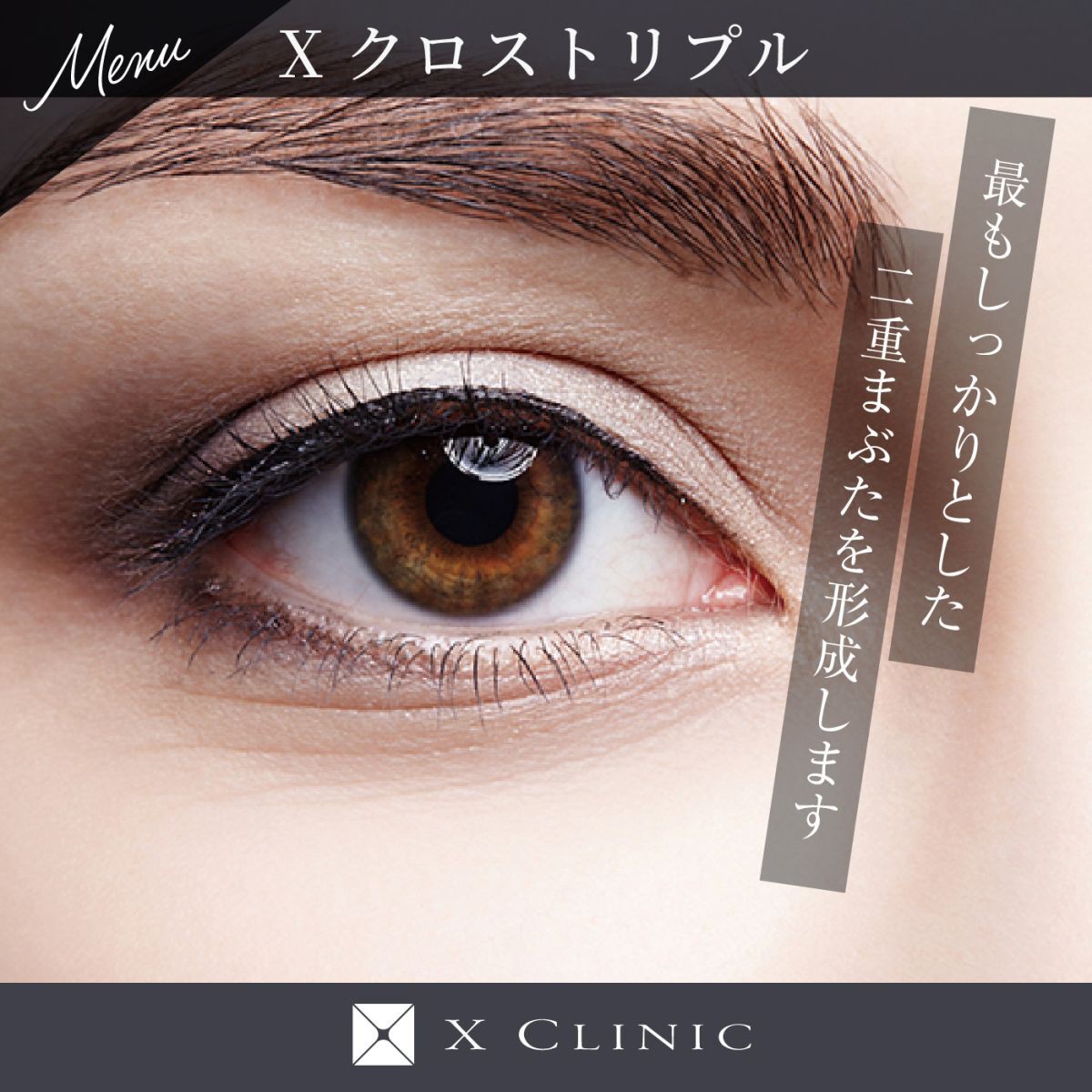 二重形成(Xクロストリプル)