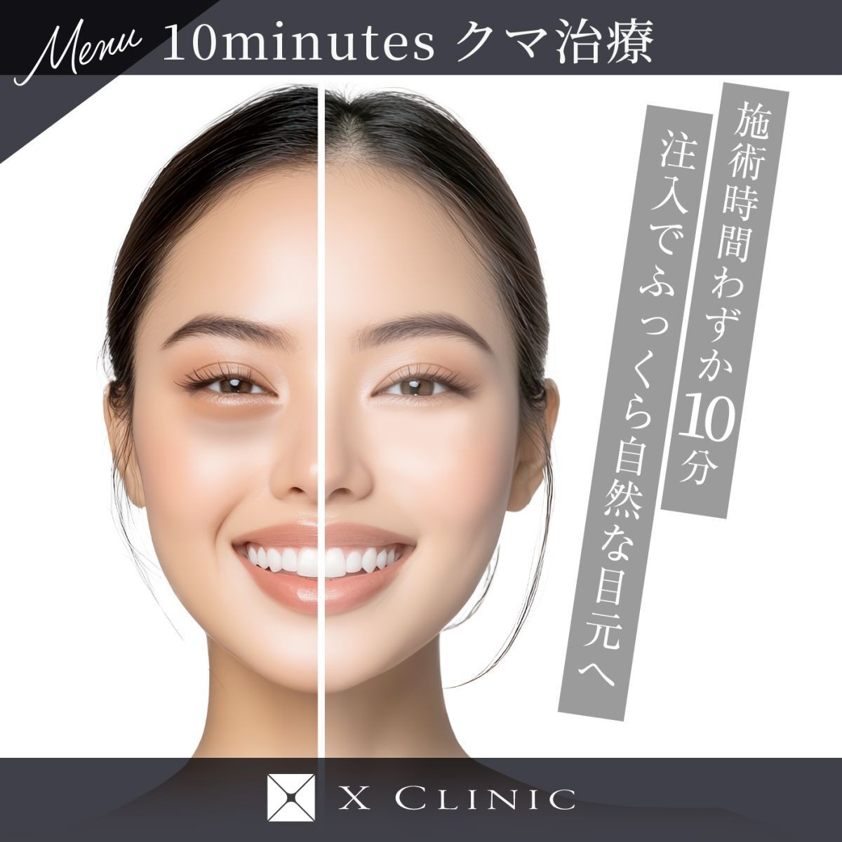 10minutes クマ治療 プレミアム