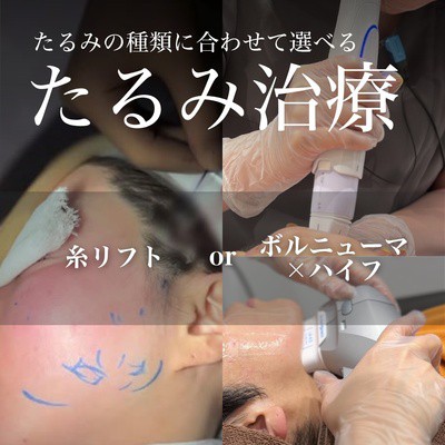 選べるたるみ治療 ブライダル徹底プラン(糸リフト10本orボルハイ)